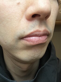 ナノハナ/鹿沼市全身脱毛の美容室ナノハナ