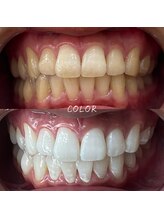 カラー(COLOR)/セルフホワイトニング効果☆