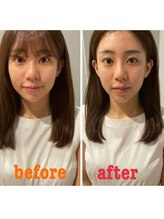 マホロバ(mahoroba)/美容鍼＋EMS