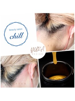 ビューティサロン チル(beauty salon chill)/うなじwax