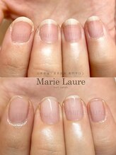マリーロール 梅田店(Marie Laure)/自爪育成/深爪矯正/ネイルケア