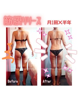 ビューティサロン キヨの部屋(beauty salon)/【筋膜リリース】月１×半年