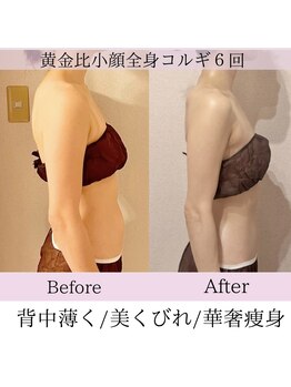 ピーチハート(Peach Heart)/黄金比小顔全身コルギ