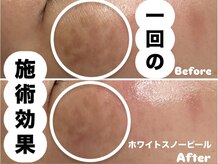 メット(met)