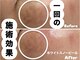 メット(met)の写真