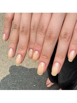 ティリット(TILLIT)/