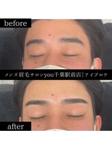 ユー 千葉駅前店(you)/ビフォ－アフター写真