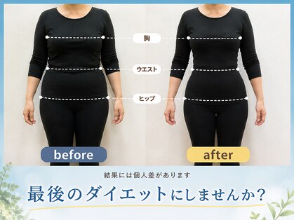 ヨサパーク サク 香椎店(YOSA PARK Saku-r)の写真