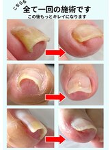 001 新横浜/一回の施術でここまで矯正