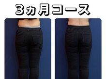 久留米スポーツ整骨院 整体院/エステ◆痩身インディバエステ