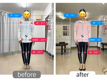 ナオル整体 大里院(NAORU整体)/1か月後のAI姿勢解析