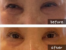 ココモンド(COCOMONDO)/幹細胞フェイシャル/エイジング