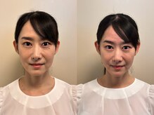 養美ラボ(YOBI Labo)/ビフォーアフター