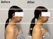 ベール(BEHL)/コルギのBefore After