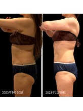 クールヴィラ(Cool Villa)/