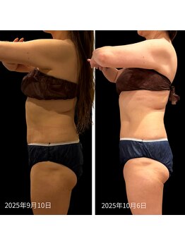 クールヴィラ(Cool Villa)/