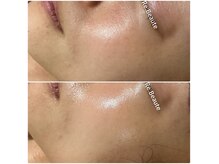 トータルビューティサロン リボーテ(Re:Beaute)