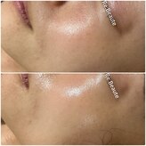 トータルビューティサロン リボーテ(Re:Beaute)