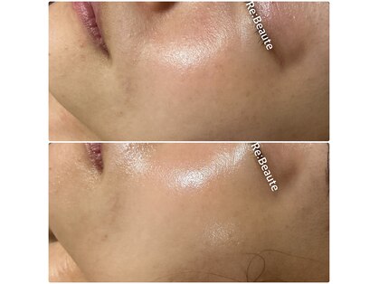 トータルビューティサロン リボーテ(Re:Beaute)の写真