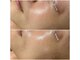 トータルビューティサロン リボーテ(Re:Beaute)の写真