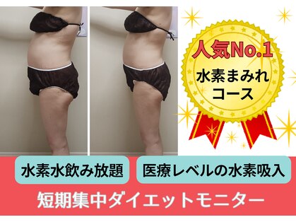 ヨサパーク ミミ 高野店(YOSA PARK mimi)の写真