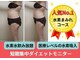 ヨサパーク ミミ 高野店(YOSA PARK mimi)の写真