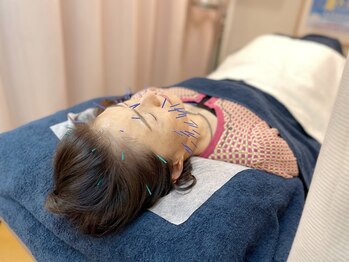 こじま 富雄団地接骨院/ベーシック美容鍼