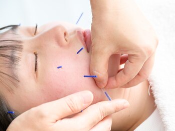 佐藤鍼灸院 美顔鍼プレム(美顔鍼PUREMU)/顔の施術3