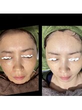 ココスタイルビューティー(COCOSTYLE beauty)/継続1年！