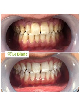 ルブラン 奈良店(Le Blanc)/大事なイベントの前に！