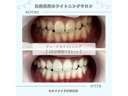 セルフメイド 宇都宮店(SELFMADE)の写真