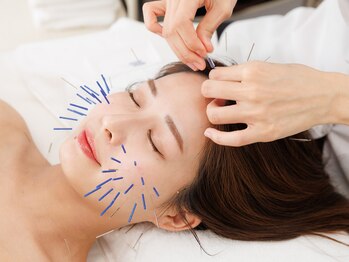 レオ(LEO)/人気No.1 美容鍼standardコース!