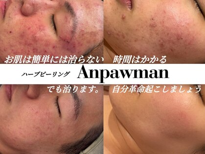 アンパウマン(Anpawman)の写真