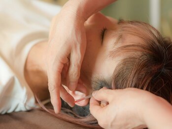 はるもにあの写真/痛みも、自律神経も、美容も。“癒す”と“整える”が一つで叶う鍼灸サロン。