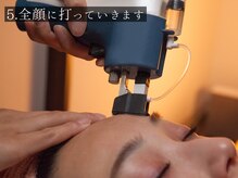 サロン アイプラス(salon i plus)/5.細部まで丁寧に打っていきます