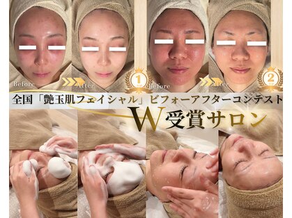 マノマノ エミュー(manomano emu)の写真