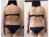 上半身or下半身☆ハイパーナイフ+リンパマッサージ&ハイパーウェーブ//60分