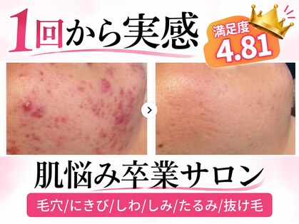 ミライ(Mirai)の写真