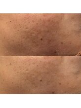 アンバー(amber)/くすみが気になる方ハーブ◎