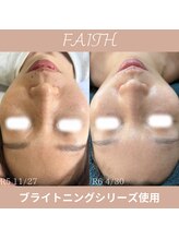 リーブル(LIBRE)/フェースホームケア