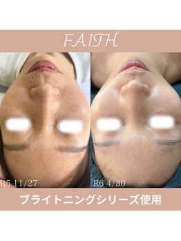 リーブル(LIBRE)/フェースホームケア