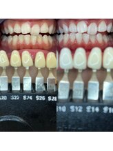 トウキョウスワーズ 池袋店(TOKYO SWRS)/#ホワイトニング #池袋 #渋谷