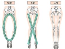 ABC整体スタジオ 武蔵小杉/整体でO脚X脚を改善へ