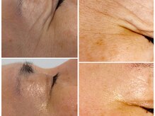 ボディメイキング キキ(Bodymaking KIKI)の雰囲気（肌の内側から改善を促すエイジングケアメニューが人気）