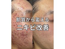 ラ ジェム(La gemme)