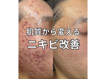 ラ ジェム(La gemme)の写真