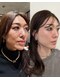 ヒメミ(Himemi)の写真/インセルダムで小顔・たるみ改善！毛穴の開き、フェイスラインをスッキリ◎