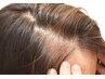 【髪の毛の老化が気になる方】ヒト幹細胞100％使用育毛促進☆30800→22000