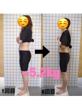 アイユーサロン(愛YOUsalon)/ダイエット 2ヶ月