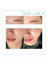 スキン ラボ ケー(Skin lab K)/潤い溢れる韓国美肌ケア